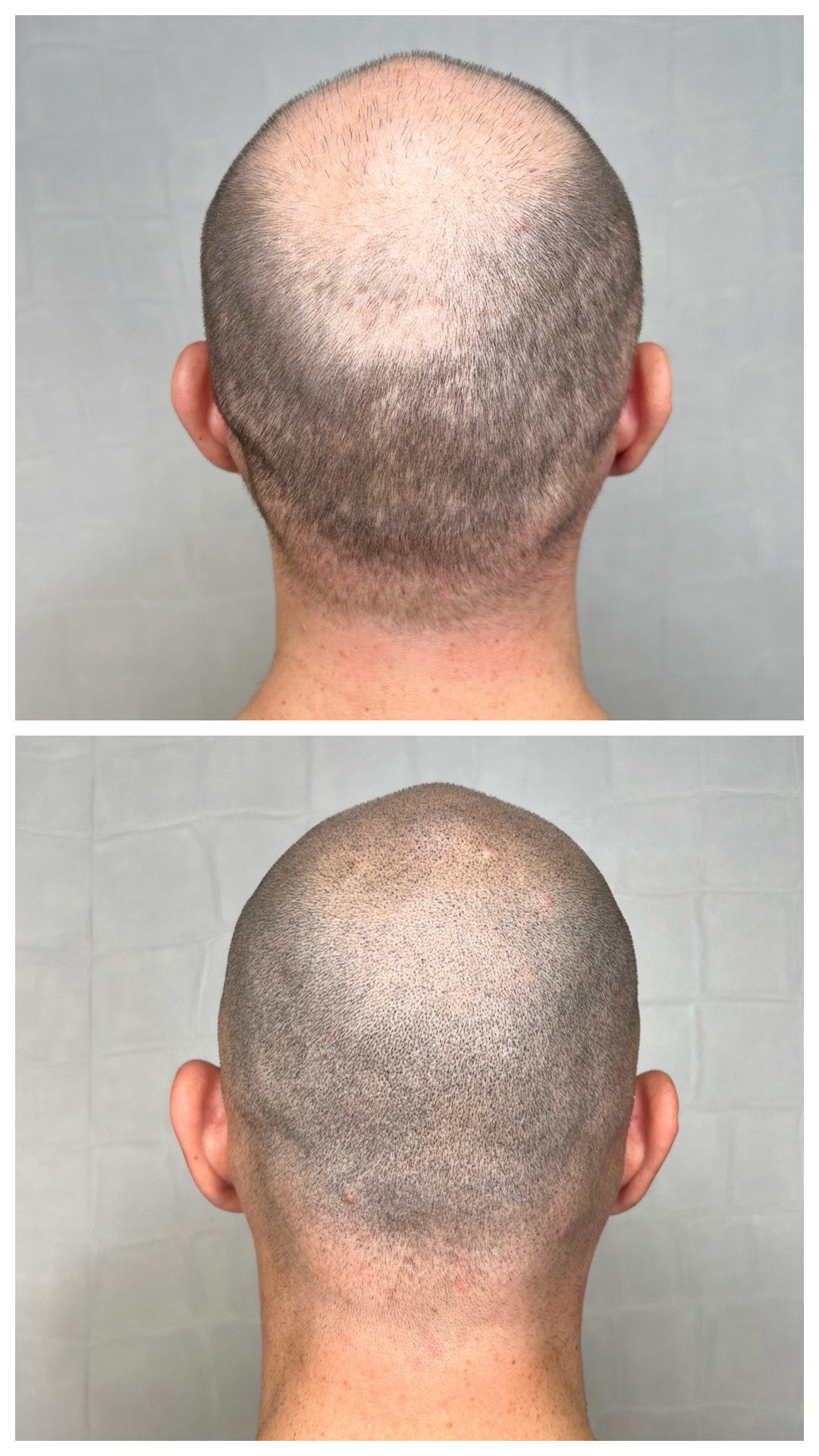 F3DC3865-05B6-47F9-A840-328330B50402